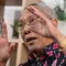 Prof Tjandra: Tragedi Dokter Icha Cerminkan Beratnya Tugas Medis