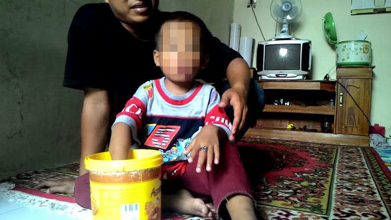 Gara-gara Cincin Batu Akik, Bocah Ini Menangis Kesakitan