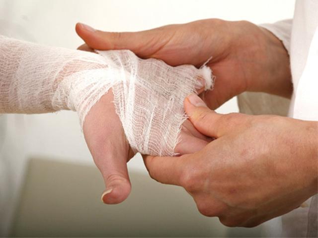 6 Cara Sembuhkan Luka Lepuh Secara Alami Aman Dan Mudah Hot Liputan6 Com