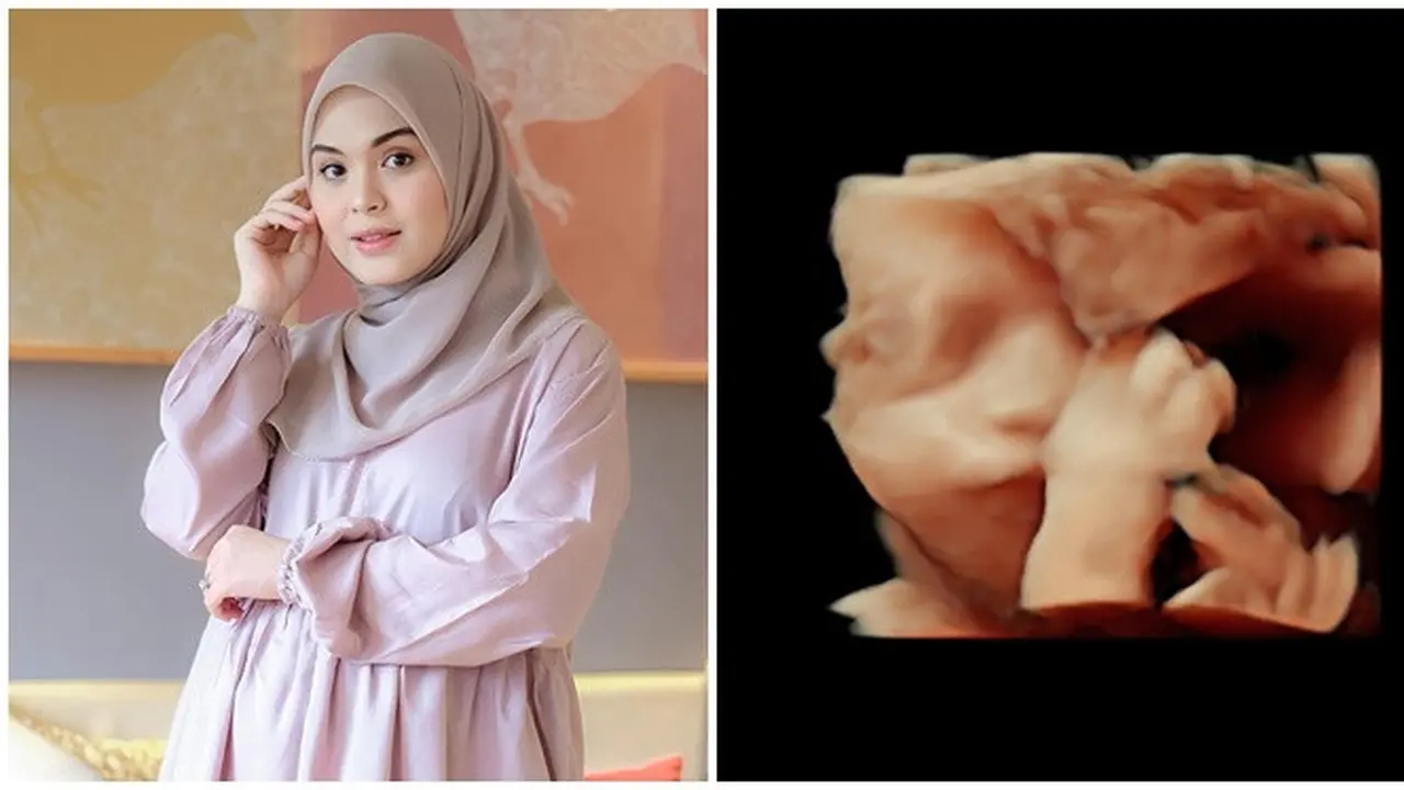 6 Momen Vebby Palwinta dan Suami Ungkap Jenis Kelamin Buah Hatinya