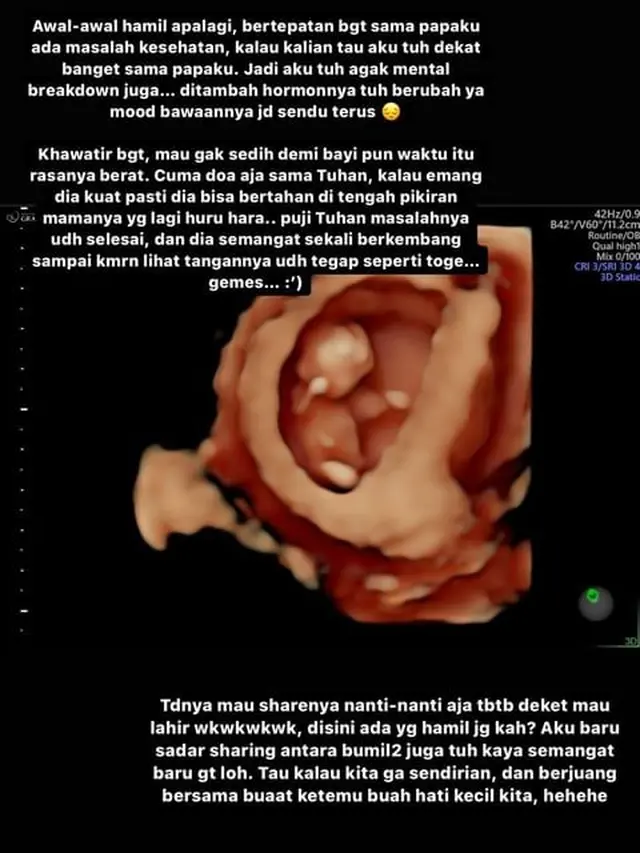 7 Potret Jonatan Christie dan Shanju Umumkan Hamil Anak Pertama, Penuh Kebahagiaan