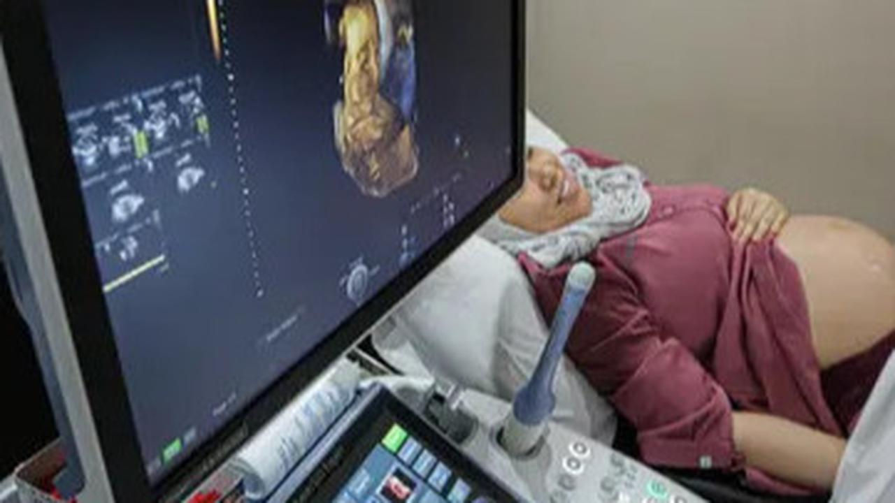 Cerita Lucu Ketika Gus Baha Cari Tahu Kenapa Saat Ini Dokter Kandungan Rata-Rata Laki-Laki