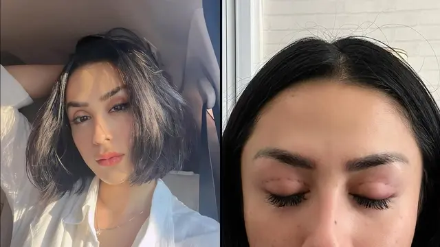 Selvi Kitty Oplas Kelopak Mata