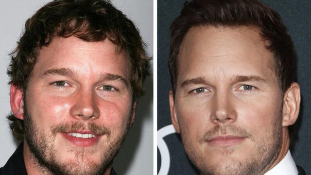 Artis-Artis Hollywood Ini Mukanya Beda Banget dari 10 Tahun Lalu