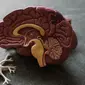 Ilustrasi Penanganan Pecah Pembuluh Darah Otak Tanpa Pembedahan/dok. Unsplash Robina