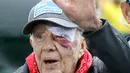 Mantan Presiden AS, Jimmy Carter setibanya paad acara yang digelar Habitat for Humanity di Nashville, Tennessee, Senin (7/10/2019). Tampil di depan publik, mata kiri pria 95 tahun itu memar dan mendapat beberapa jahitan di alis bagian atas setelah terjatuh di rumahnya di Georgia. (AP/Mark Humphrey)