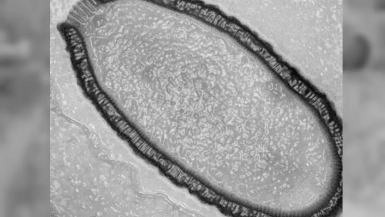 Virus Raksasa Ini Akan Dihidupkan Kembali**