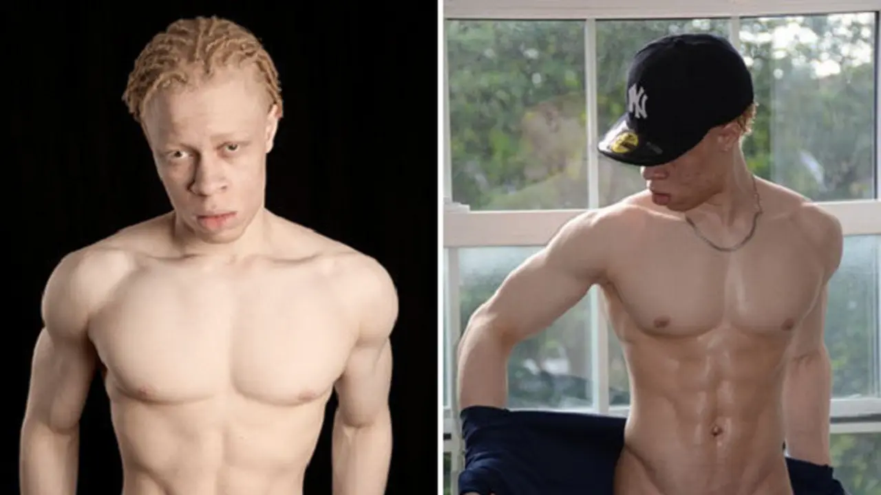  Albino Kulit Hitam Sukses Jadi Model