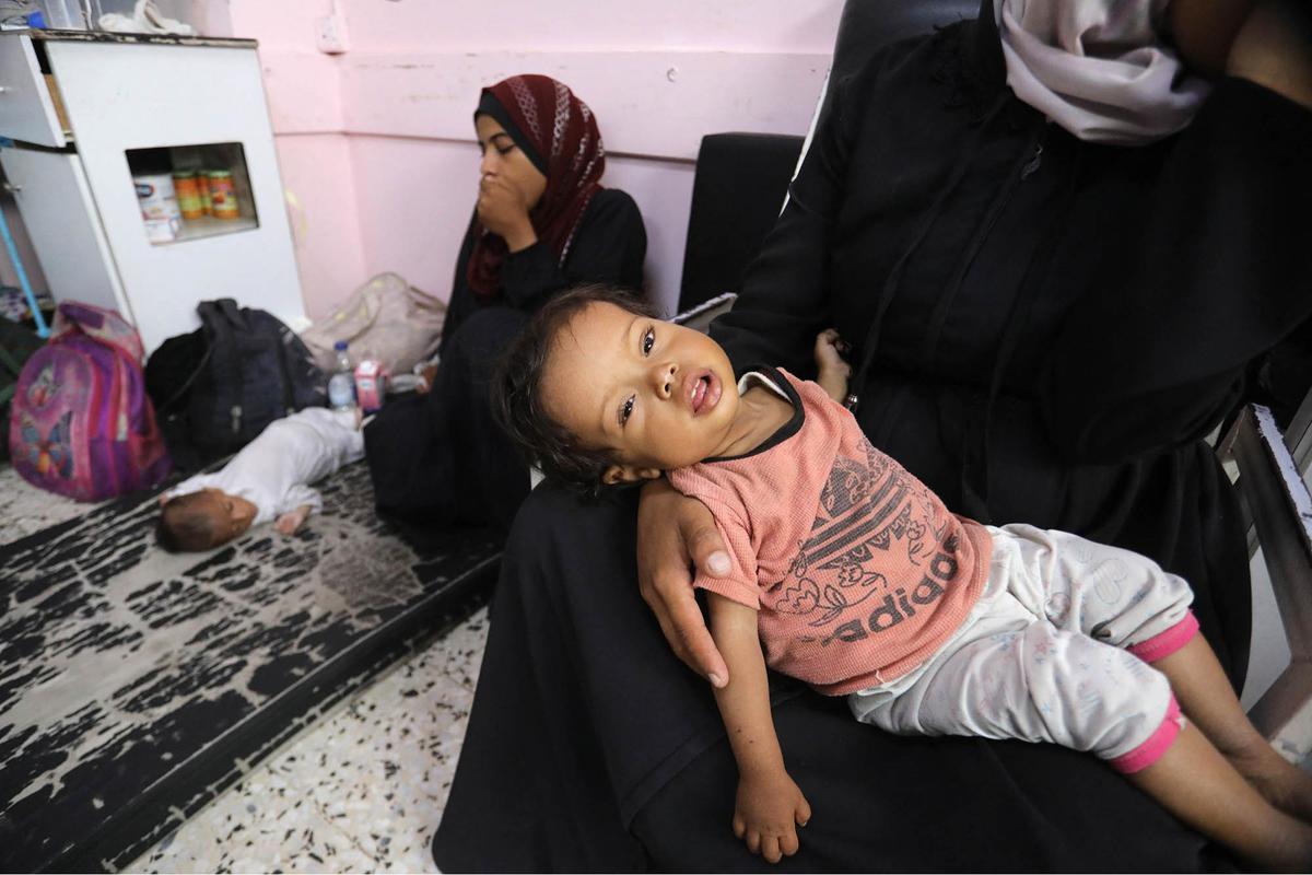 FOTO: Tubuh Kecil yang Lapar, Potret Pedih Bayi Gaza di Tengah Ancaman Kelaparan Massal