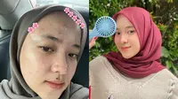 7 Potret Nissa Sabyan Pede Pamer Foto Berjerawat Tanpa Makeup, Telaten Perawatan