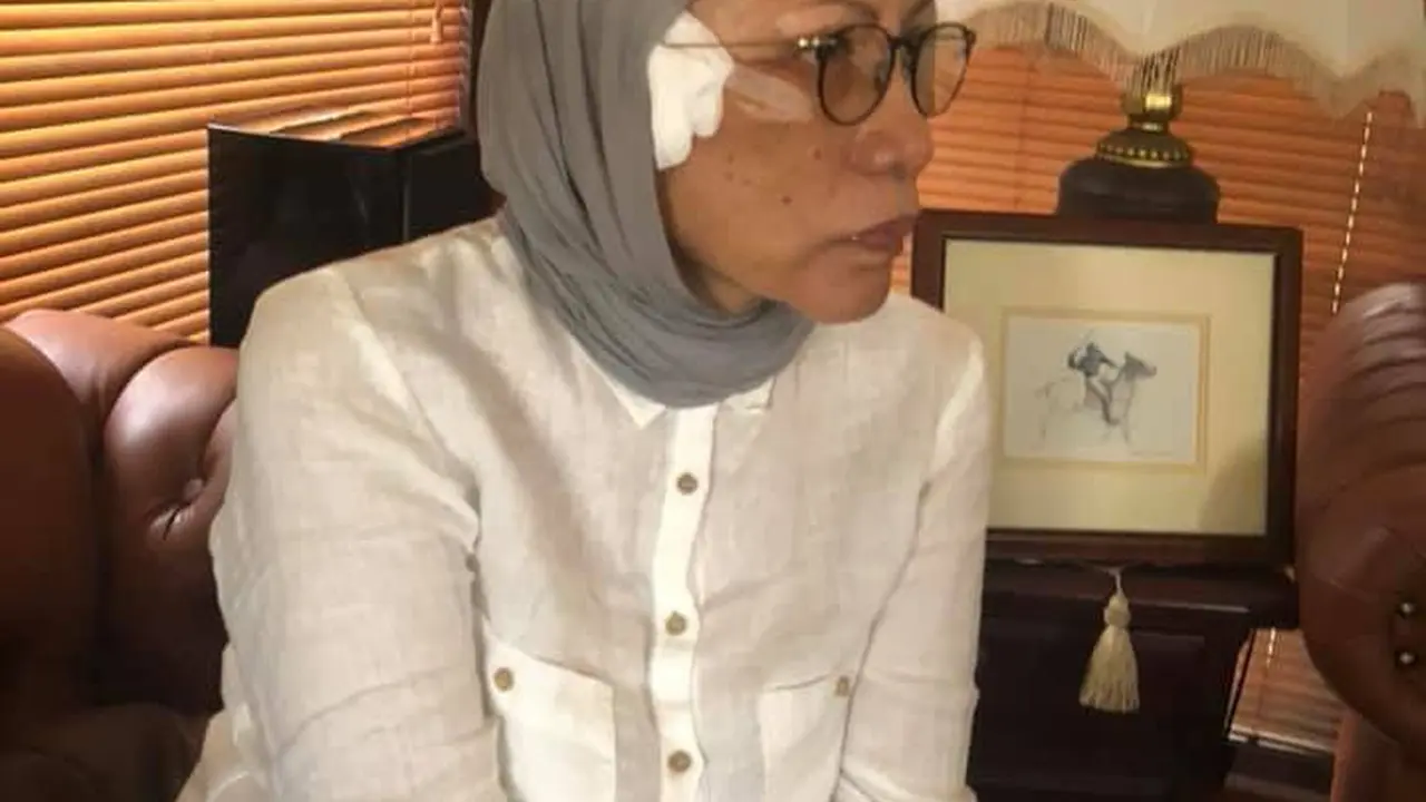 Jalani Sedot Lemak, Ratna Sarumpaet Bayar Berapa?