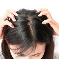 Fakta Tentang Kutu Rambut yang Anda Harus Tahu
