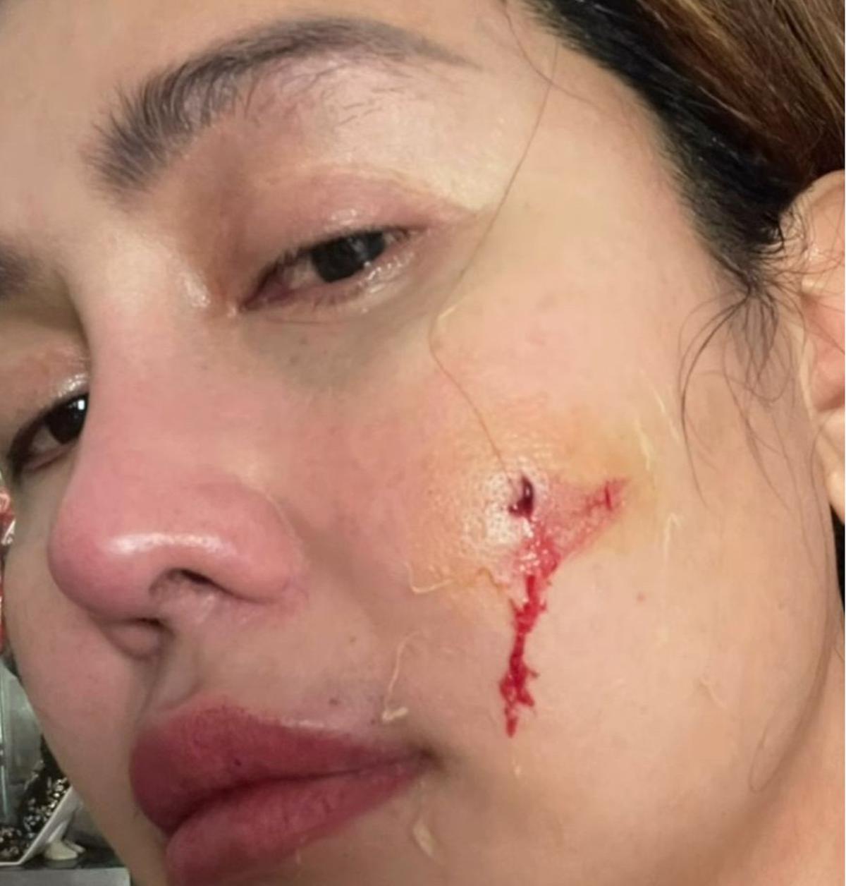 Pedangdut Ratu Meta Unggah Video Cekcok dengan Suami, Ungkap Kekerasan yang Diduga KDRT