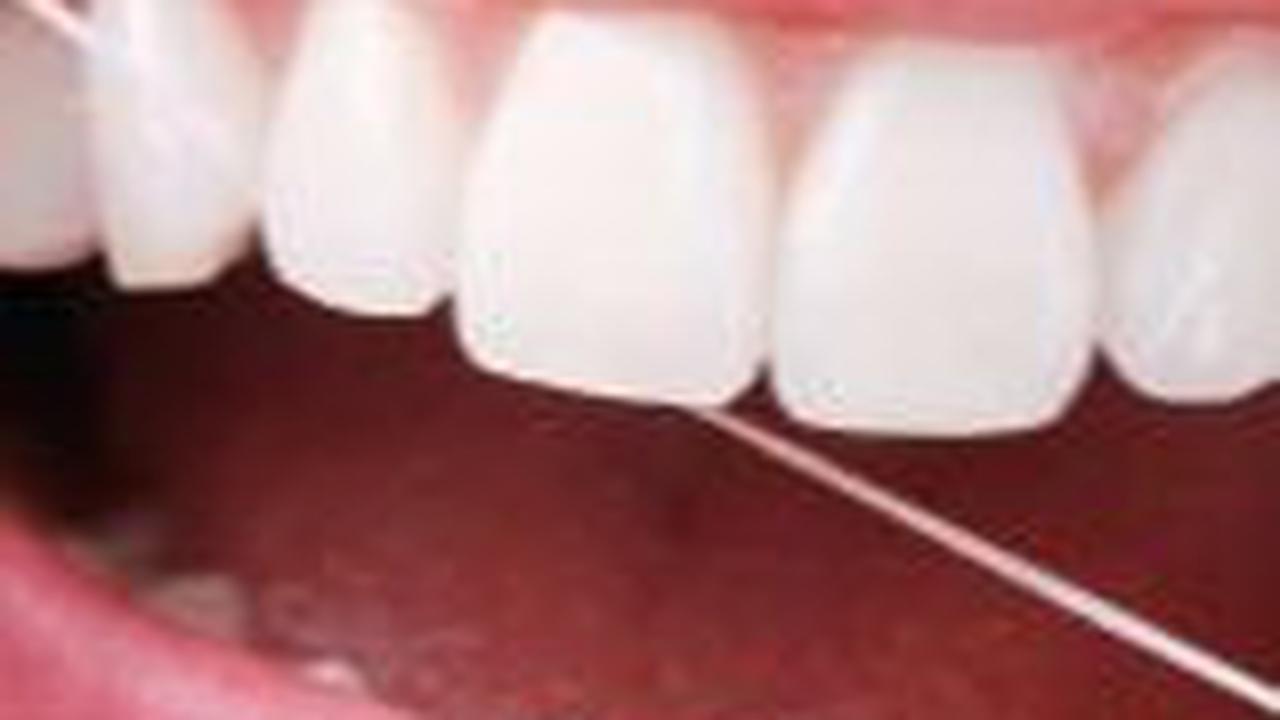 <b>3. Gunakan Dental Floss</b><br>