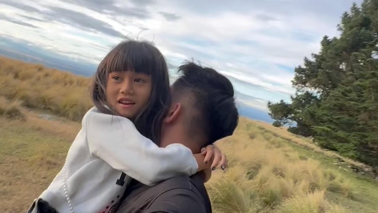 Boy William Kena Ulti Keponakan, Disebut Punya Hidung Palsu