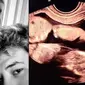 Fakta Twin to Twin Transfusion Syndrom, Penyebab Meninggalnya Bayi Kembar Irish Bella (sumber: Instagram.com/_irishbella_ & YouTube Aish TV)