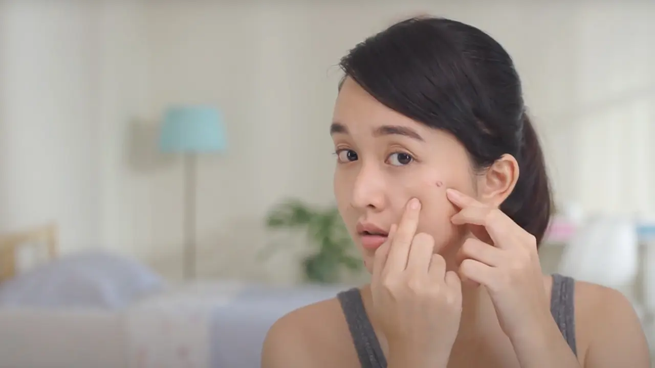 3 Langkah Cepat Usir Jerawat dan Minyak Berlebih di Wajah dengan Mudah, Penasaran?