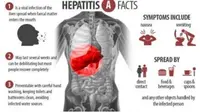 Waspadai Beberapa Gejala Hepatitis A