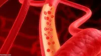 Anemia Tingkatkan Risiko Pikun pada Lansia