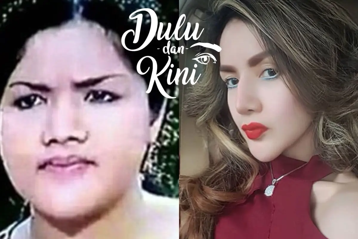 Dulu dan Kini: Transformasi Kumalasari dari Gemuk Hingga Secantik Bidadari