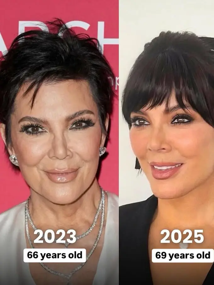 Potret Transformasi Wajah Kris Jenner di Usia 69 Picu Dugaan Operasi Plastik, Jadi Lebih Muda Mirip Kendall-Kim Kardashian