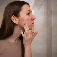 Sahabat Fimela, tak hanya dari luar, hidrasi kulit juga perlu diperhatikan dari dalam. [Dok/freepik.com]