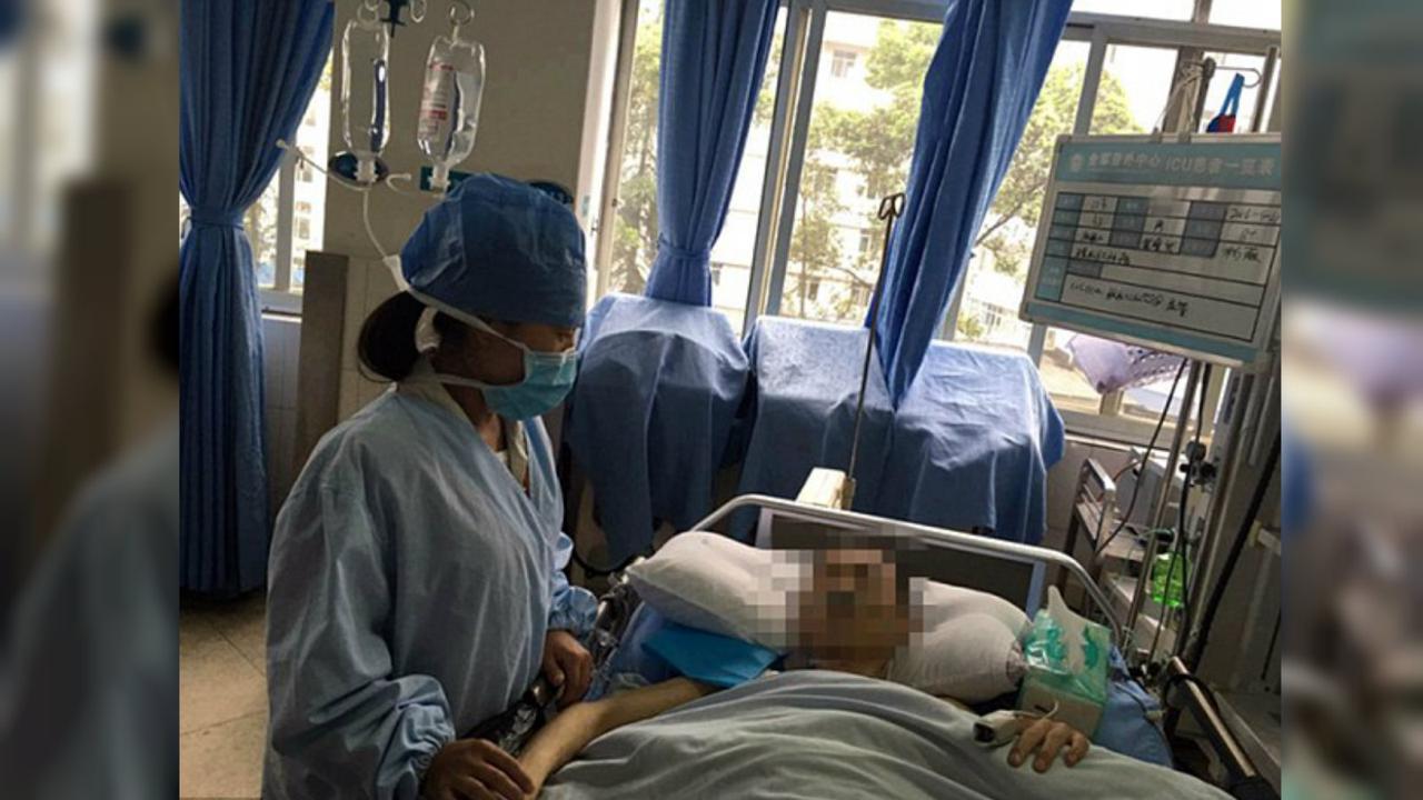 Tumor ini membuat Pria Tiongkok seperti 'Ibu Hami'