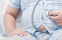 Anak Obesitas Berpotensi Terkena Penyakit Degeneratif
