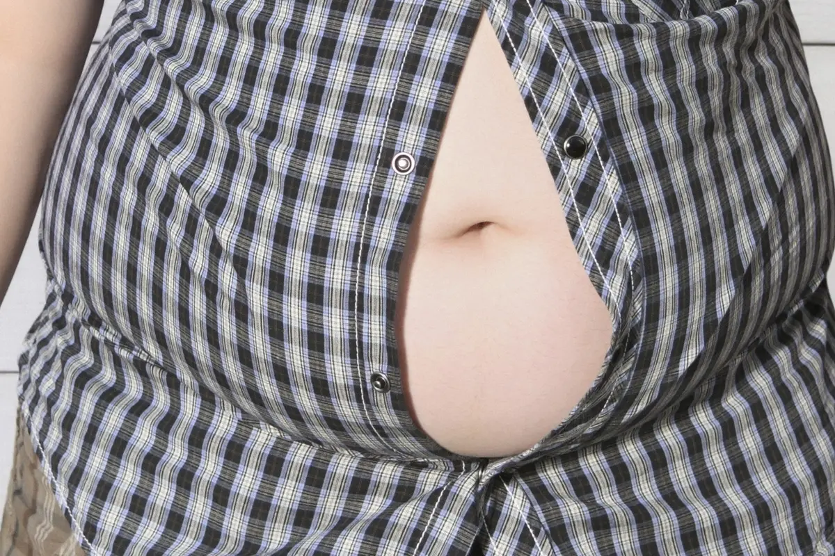 Dua Gangguan pada Penis Anak Gemuk yang Sulit Disunat