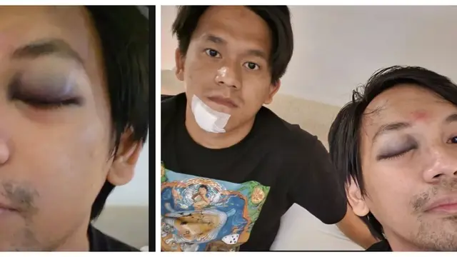 Rian D'Masiv Bersyukur Bisa Selamat dari Kecelakaan. (instagram.com/rianekkypradipta)