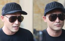 Makin Ganteng, Ini Pengakuan Indra Bruggman Operasi Plastik di Bagian Mata