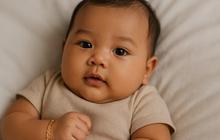 Iritasi Kulit Bisa Ganggu Tidur Bayi, Dokter Ungkap Dampak dan Cara Mengatasinya