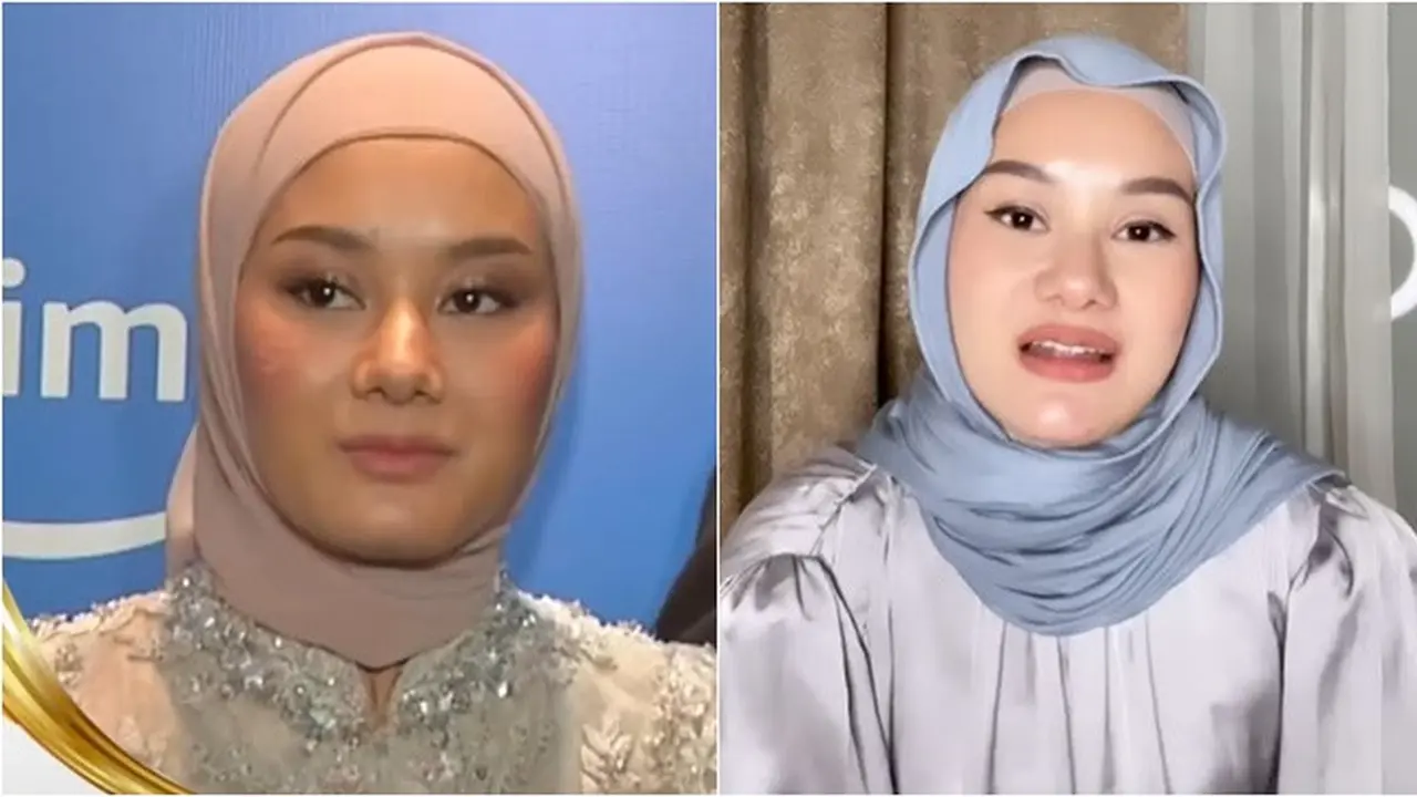 Potret Wajah 6 Artis Ini Jadi 'Korban' Kamera Wartawan, Perbedaannya Disorot