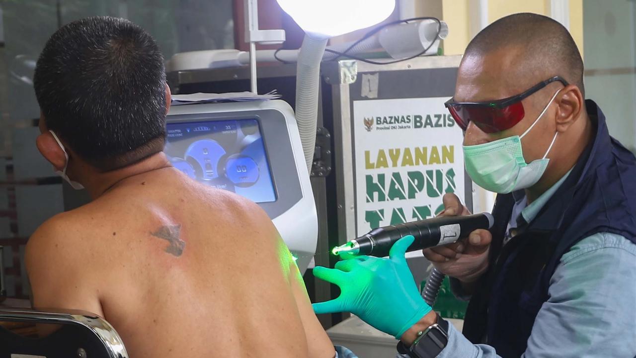 FOTO: Layanan Hapus Tato Gratis Sambut Ramadhan di Jakarta