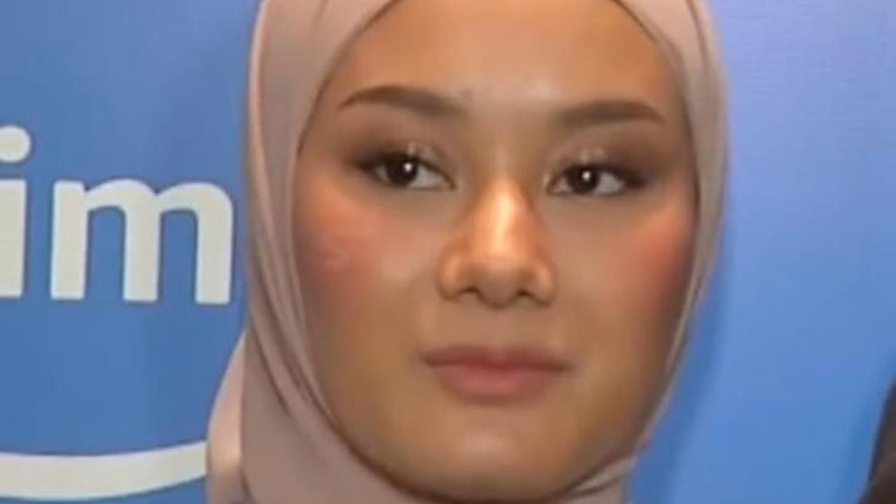 Wajah Dinda Hauw Jadi Sorotan