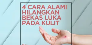 4 Cara Alami dan Ampuh untuk Hilangkan Bekas Luka pada Kulit