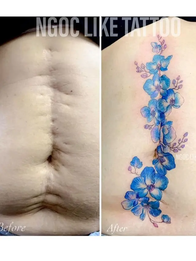 7 Potret Tato Keren Sulap Bekas Luka Jadi Seni Indah