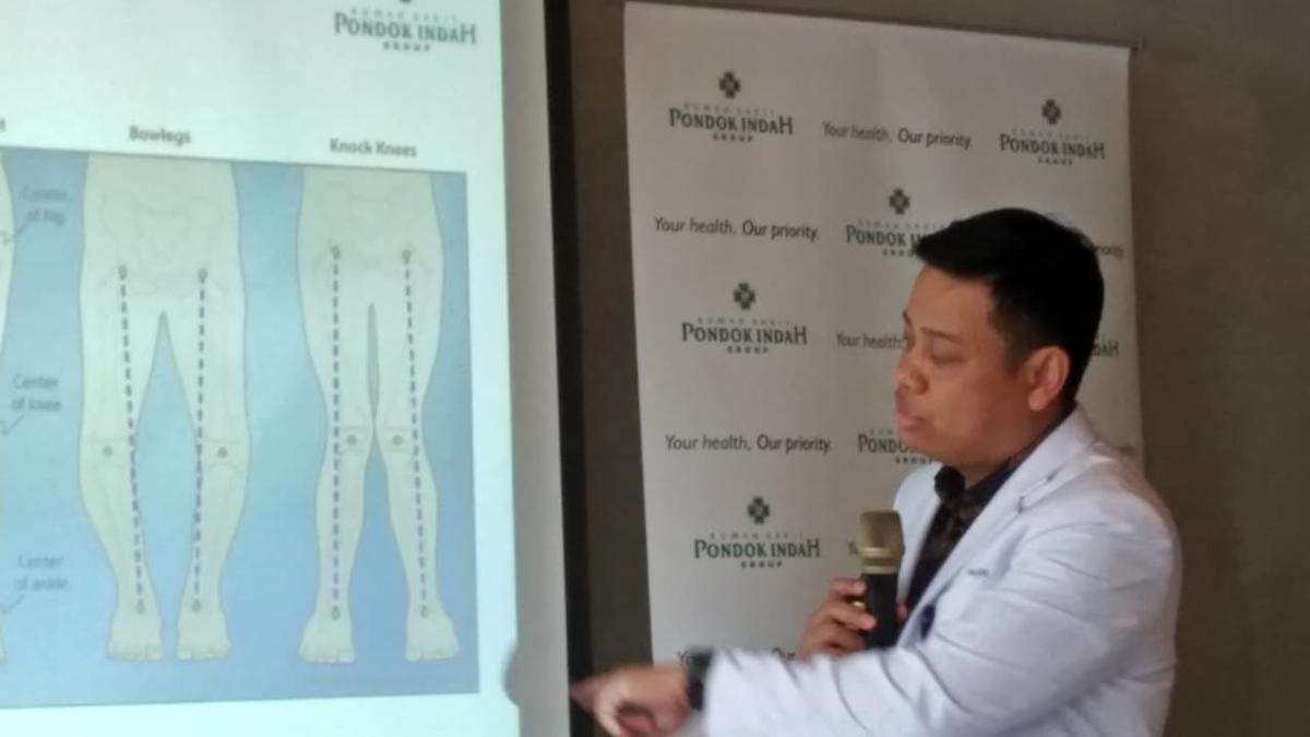 Penyebab Kaki O dan X pada Anak, Bisa karena Kekurangan Vitamin D hingga Faktor Genetik