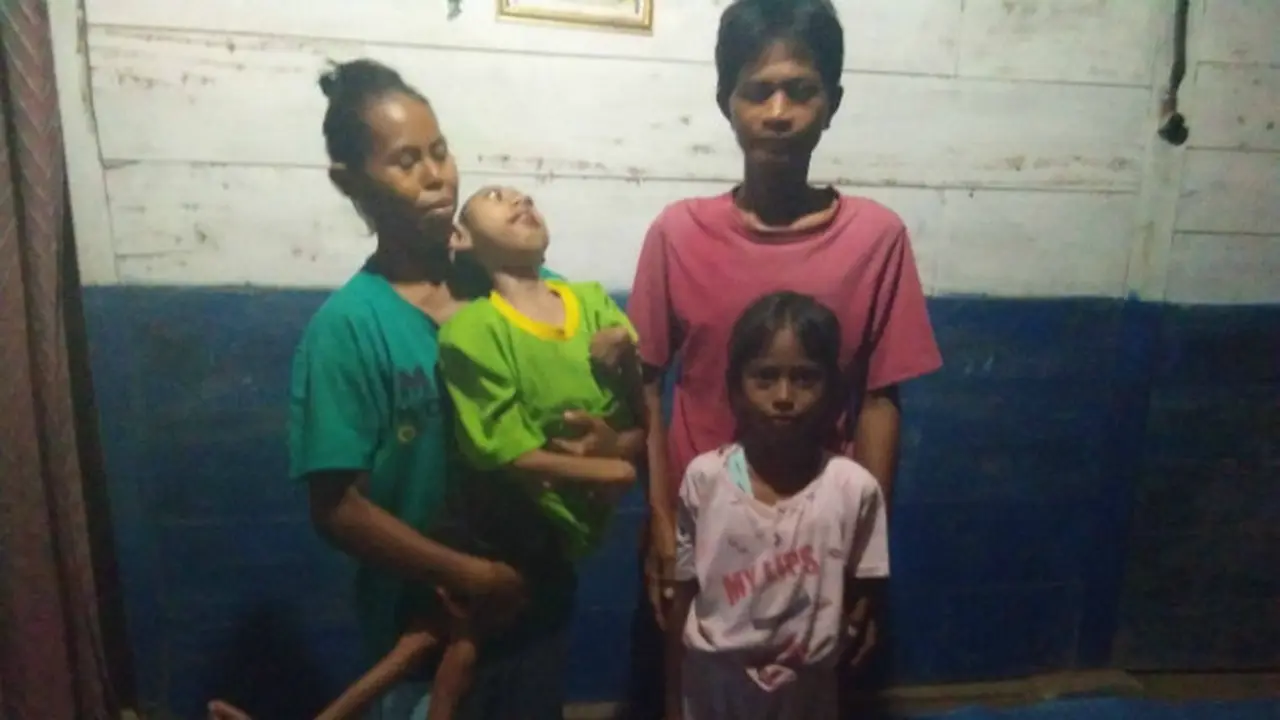 Ketika Sang Ibunda Telah Pergi dari Sisi Bocah Lumpuh di Blora