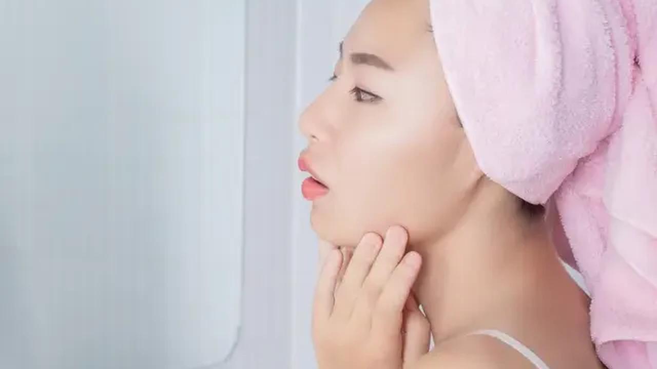 Cara Mengatasi Jerawat