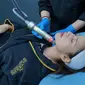 Inovasi dalam dunia perawatan kulit terus hadir. Salah satunya teknologi perawatan kulit yang menggabungkan microneedling konvensional dengan radiofrekuensi (RF) canggih.