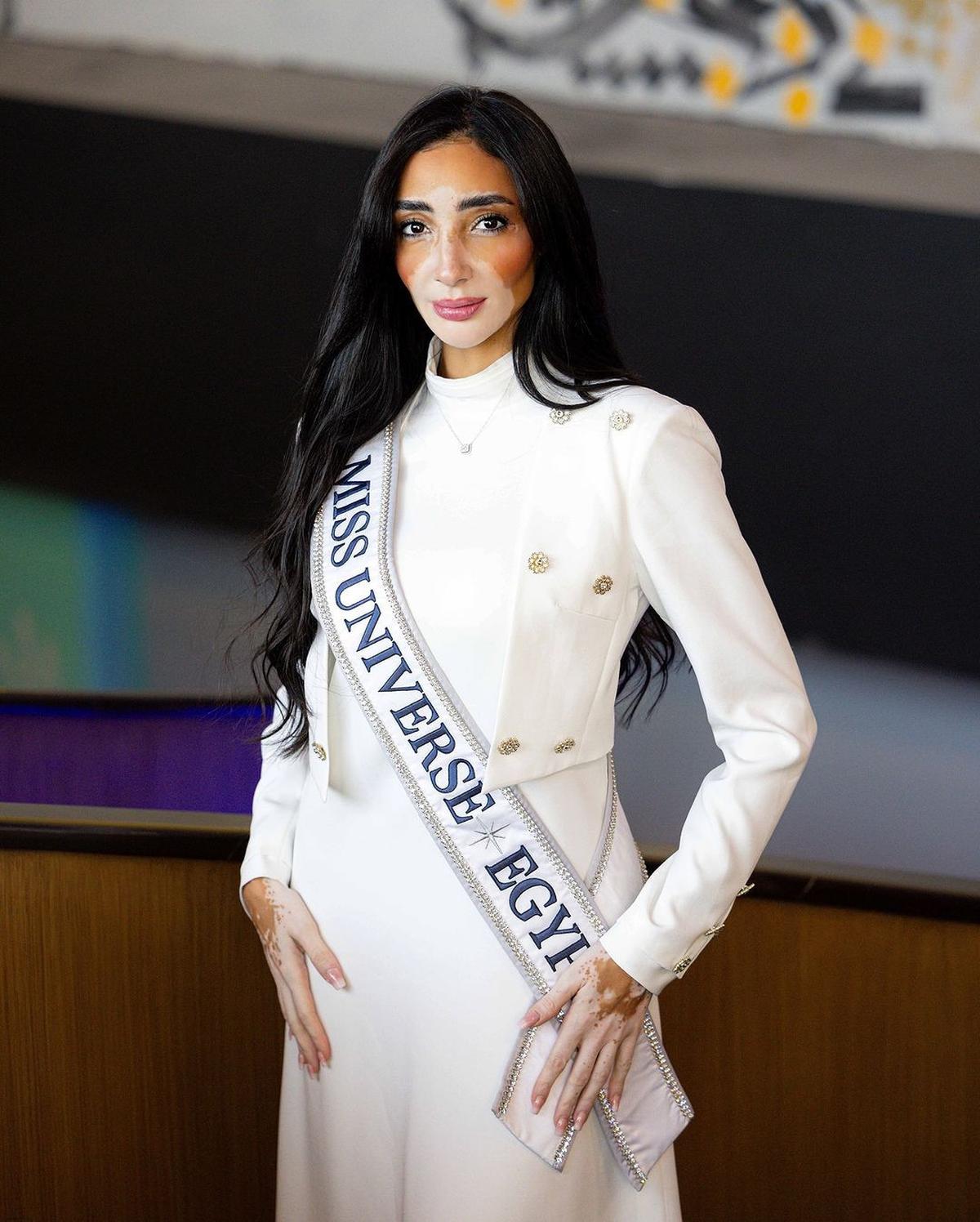 Profil Logina Salah, Miss Universe Mesir 2024 yang Buktikan Vitiligo Bukan Penghalang