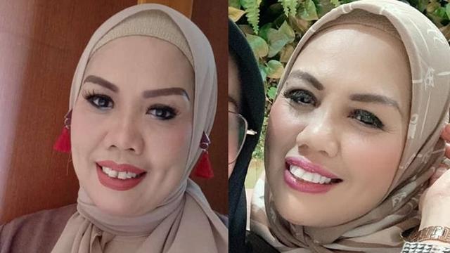 Beda Gaya Ely Sugigi Sebelum Vs Sesudah Potong Gigi (sumber: instagram/ellysugigi_real_)