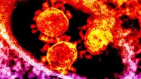 Middle East Respiratory Syndrome coronavirus (MERS-CoV) masih belum dapat dianggap sebagai ancaman global.