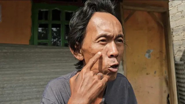 Sudrajat (50) pedagang es kue menjadi korban penyiksaan yang dilakukan oknum TNI dan Polri.