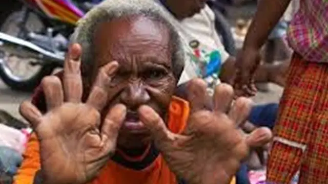 Foto: copyright Odditycentral.com