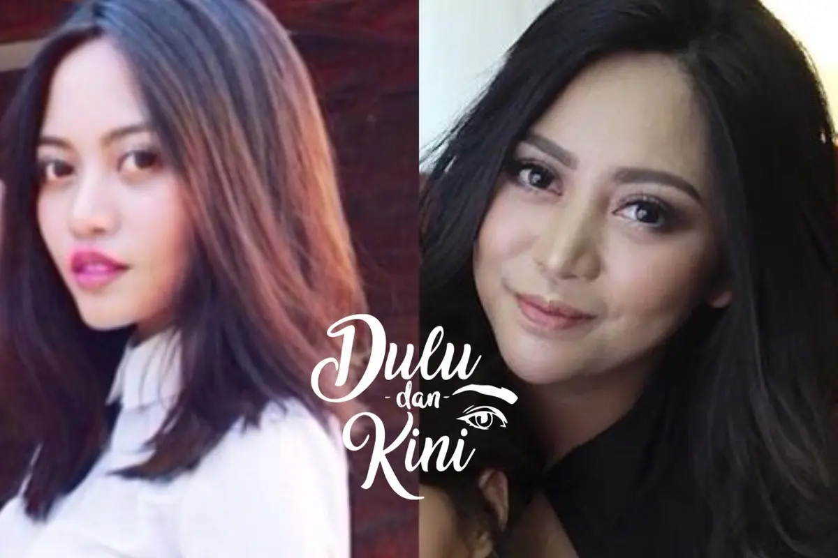 Dulu dan Kini: Transformasi Rachel Vennya dari Tampilan Aneh Hingga Memesona