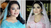 Kahiyang Ayu Jadi Bukti, Cantik Tak Sama dengan Kurus
