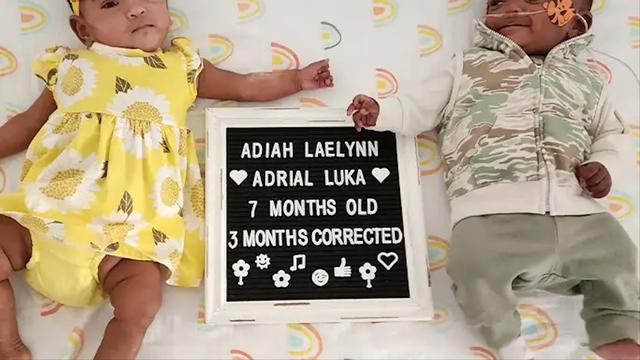 Adiah Laelynn Nadarajah dan Adrial Luka Nadarajah Adalah Nama Bayi Kembar Paling Prematur di Dunia (Sumber: guinnessworldrecords.com)