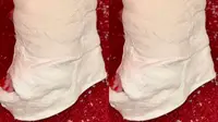 Kim Kardashian Tetap Modis Meski Cedera Patah Kaki, Pakai Heels Berbalut Perban